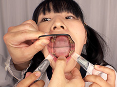 kyuuhendan-0039【本編フル視聴】 【歯フェチ】新口腔内観察 - MIWA by 口腔仙人（Dr. X）