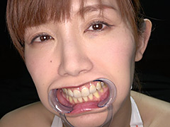 adoa-1420【本編フル視聴】 【歯・口内フェチ】「綺麗なお姉さんの激レアな治療跡がある歯・口内・のどちんこ観察！」美泉咲