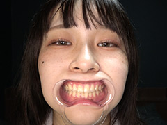 adoa-1617【本編フル視聴】 「人気女優 桐谷すずねチャンの激レア口内・歯・舌ベロ観察！」桐谷すずね