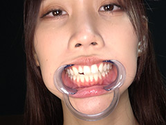 adoa-1729【本編フル視聴】 【歯・口内】単体女優デビューを飾った人気女優の貴重な口腔・のどちんこ・舌ベロ観察★