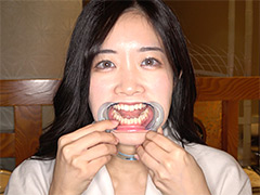 adoa-2069【本編フル視聴】 【口内】「国民的女優激似美女ことねチャンの初めての口内・のどちんこ観察！」ことね（5）